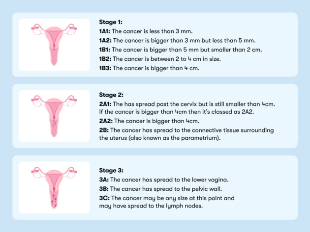 How Long Does Cervical Cancer Take To Spread